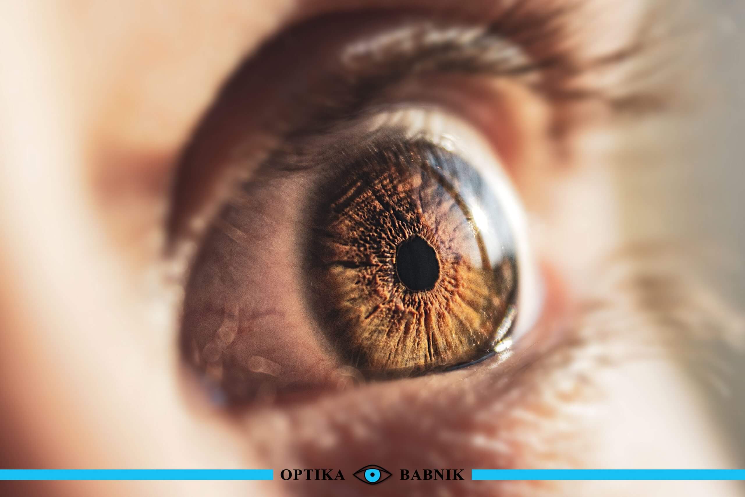 Težave z vidom in kako jih odpravimo